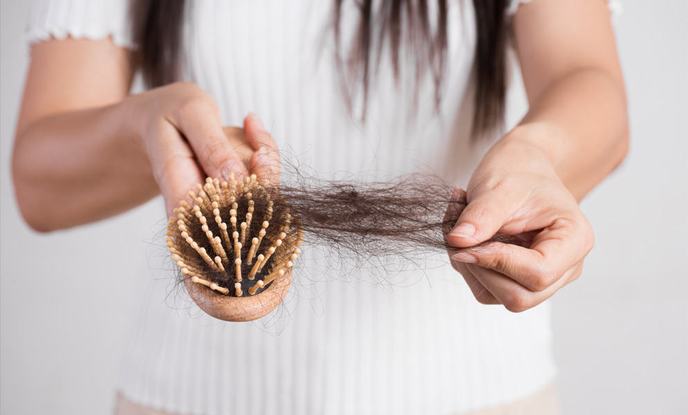 Pessoa com escova cheia de cabelo nas mãos fazendo referência a Eflúvio Anágeno.