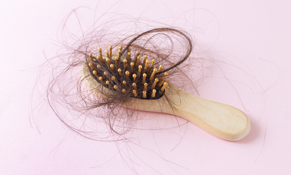 Escova com muitos cabelos, fazendo referência a causas da queda de cabelo.