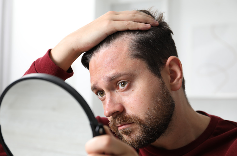 Homem olhando preocupado seu cabelo no espelho, fazendo referência à queda de cabelo masculino.