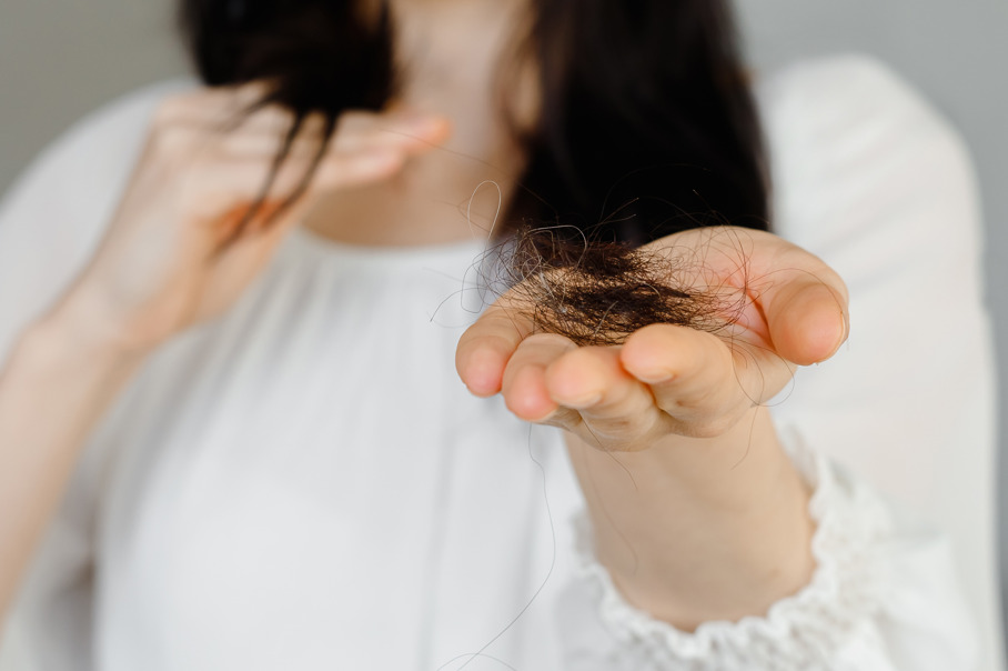 Mulher segurando fios de cabelo, fazendo referência à queda de cabelo após cirurgia.