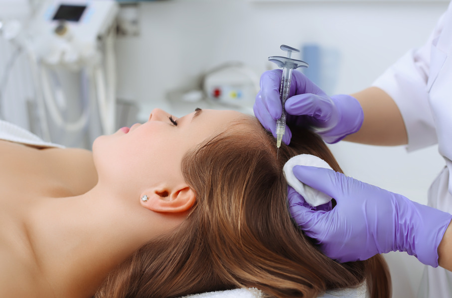 Mulher recebendo vitaminas no couro cabeludo fazendo referência a tratamento de queda de cabelo após cirurgia.