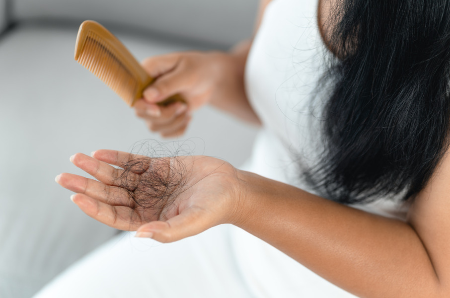 Mulher com pente e fios de cabelo em mãos, fazendo referência à psoríase capilar e queda de cabelo.