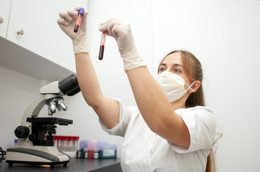 Exames para queda de cabelo: profissional de saúde segurando tubos de ensaio com sangue.