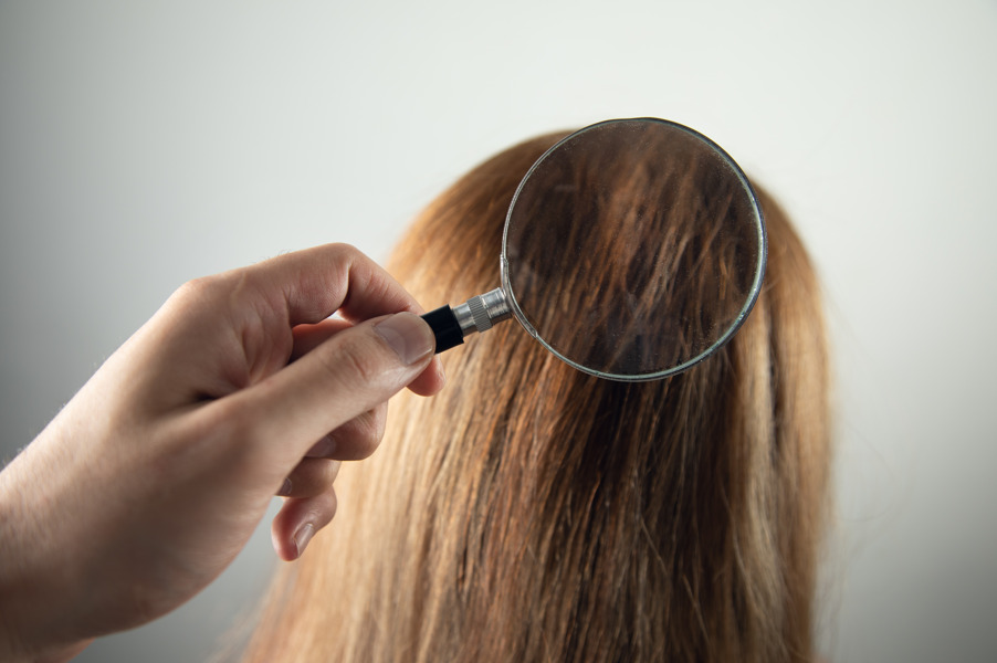 Tricologia para profissionais da saúde: pessoa com uma lupa no cabelo de uma mulher.