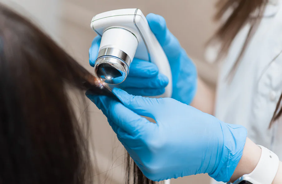Laserterapia capilar: tricologista examinando cabelo do paciente.